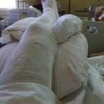 gips2