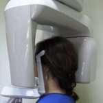Dentalni rendgen