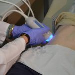 bolnica fibroscan ciroza 20