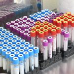 bolnica korona seroloski testovi010