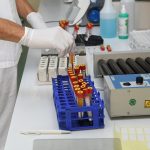 bolnica seroloski testovi korona laboratorij09