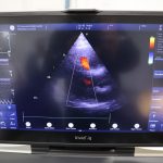 uzv pedijatrijska ambulanta mokosica 7