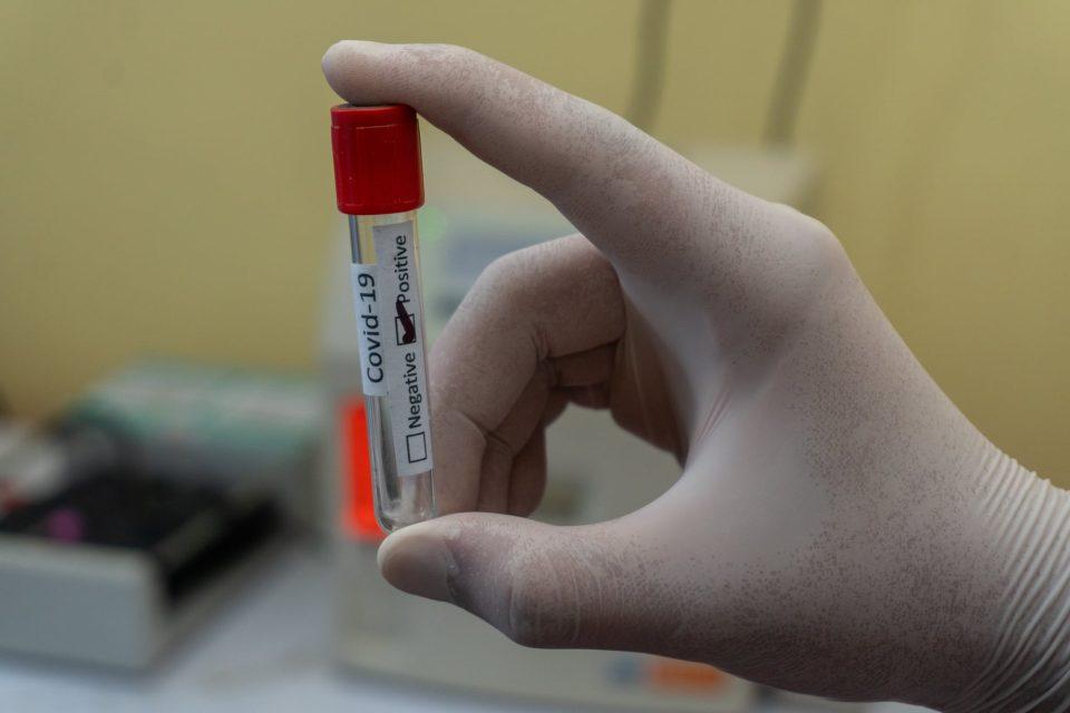PADA BROJ NOVIH SLUČAJEVA U zadnja 24 sata u Hrvatskoj umrlo 45 ljudi zaraženih koronavirusom